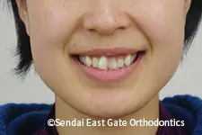 治療前