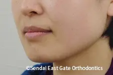 治療前