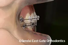 治療中