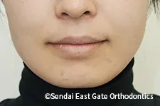 治療後