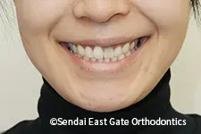 治療後