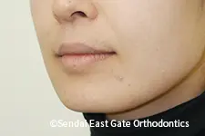 治療後