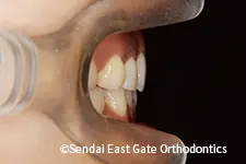 治療後