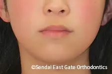 治療前