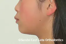 治療前