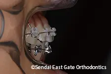治療中