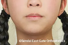 治療後