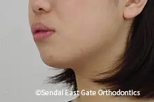 治療前