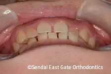 治療前