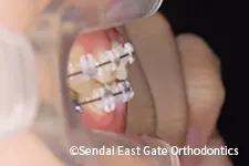 治療中