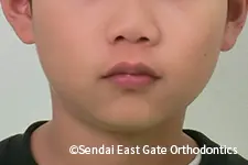 治療前