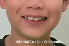 治療前