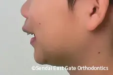治療前