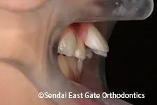 治療前