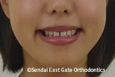 治療前