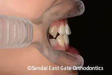 治療前