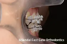 治療中