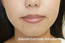 治療後