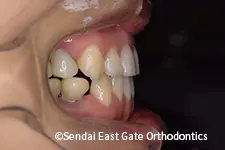 治療後