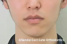 治療前