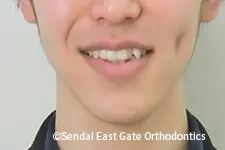 治療前