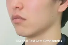 治療前