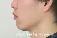 治療前