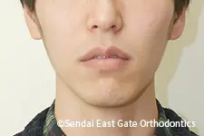 治療後