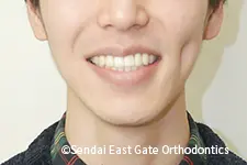 治療後