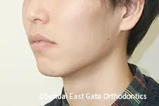 治療後