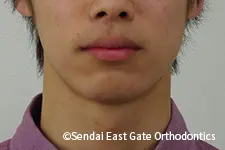 治療前