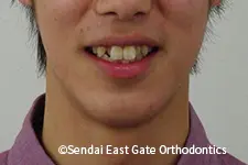 治療前