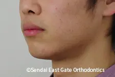 治療前
