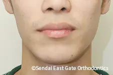 治療後