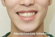 治療後