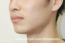 治療後