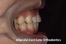 治療後