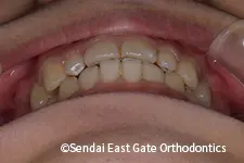 治療後