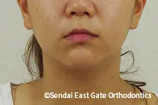 治療前