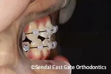 治療中
