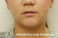 治療後