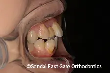治療前