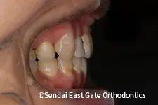 治療後