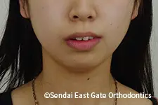 治療前