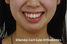 治療前