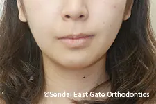 治療後