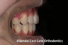 治療後