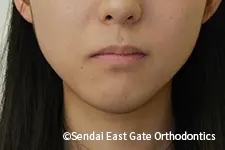 治療前