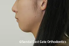 治療前