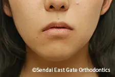 治療後